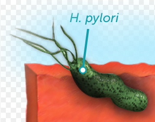 h pylori crohn's disease