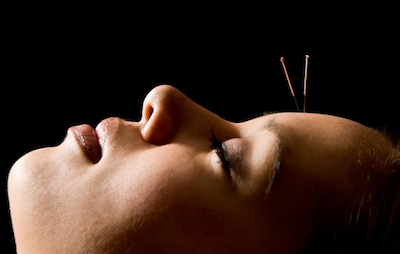 acupuncture and depression woman