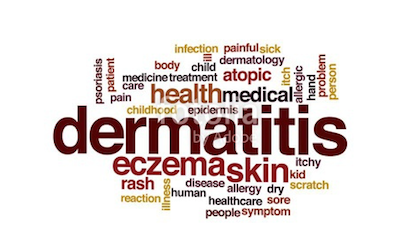 Dermatitis types of skin allergy