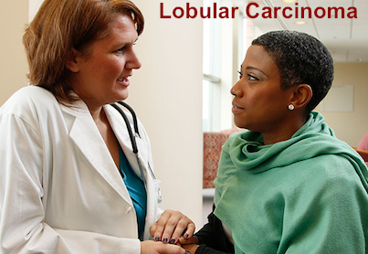 Lobular Breast Cancer