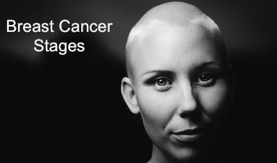 breast cancer stages woman shaved head