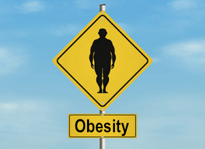 Obesity: Cause Treatment Prevention