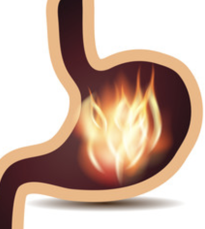 gastritis inflammation of the stomach